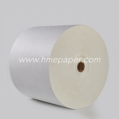 comprar Paciente plisado médico de la traqueotomía del papel de filtro de la espirometría del papel de filtro de HME online manufacture